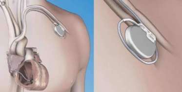 AS Medical Equipment